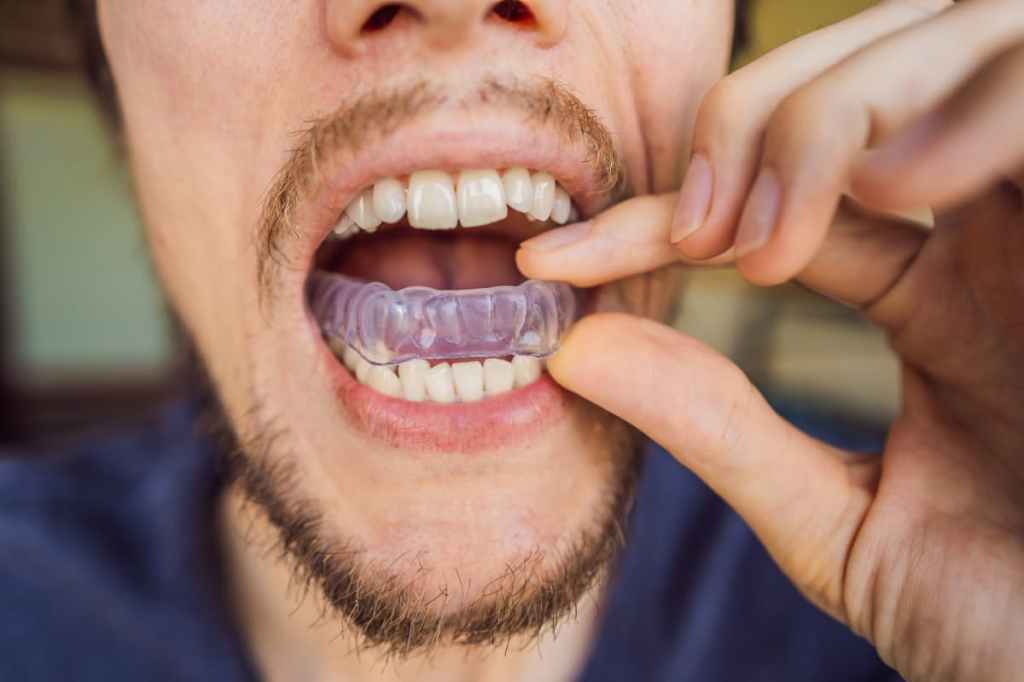 Nightguard for Grinding Teeth: What Bruxism Really Is?